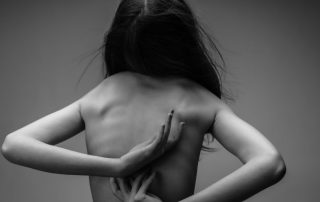 a woman with scoliosis