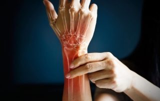 Illustration of a hand with visible skeletal structure, highlighting wrist pain in red, suggesting complex regional pain syndrome.